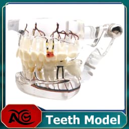 AG Teeth Neural Repair Dental Implant Pathological Model Dentist Students Communication Learning Research Oral Disease Teaching