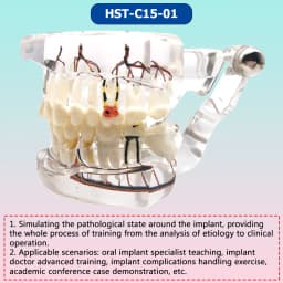 AG Teeth Neural Repair Dental Implant Pathological Model Dentist Students Communication Learning Research Oral Disease Teaching