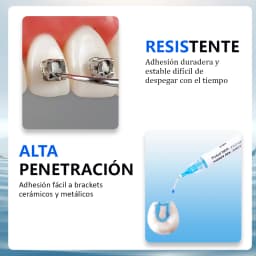Dental Braces Blue Glue Adhesivos Orthodontic Universal Light-Cure For Bracket Tube Crystal Decoration Teeth Glue Braces Kit Wit
