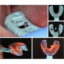JUMTOP 3 Pairs Dental Implant Tray S/M/L Full Mouth Removable Partial Mold Tray Plastic Teeth Holder Dentistry Materials