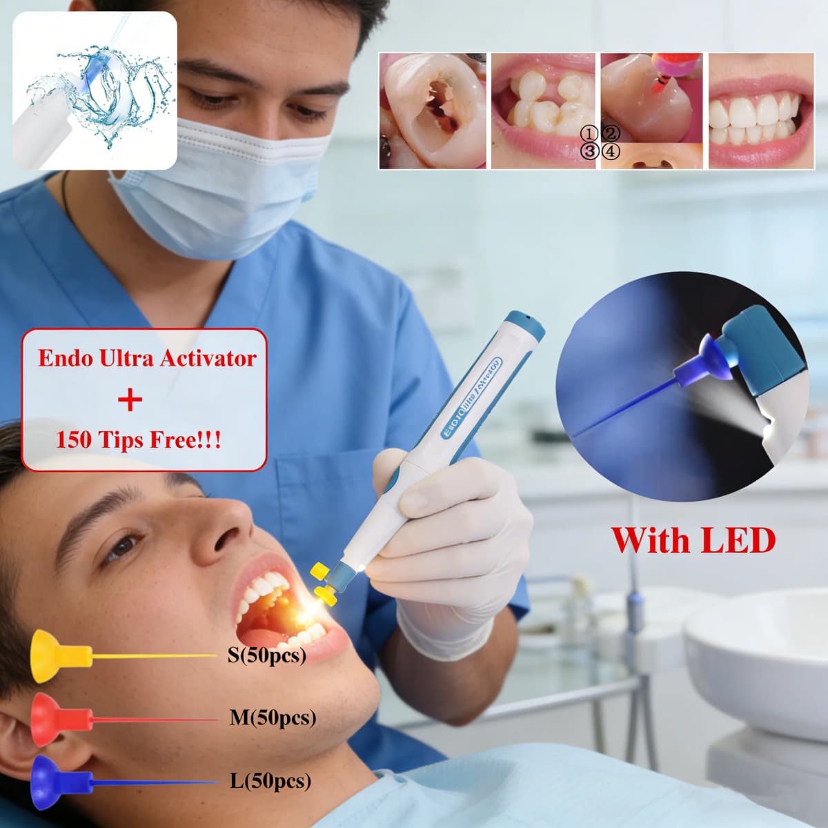 Dental Endodontic Endo Ultra Activator Wireless LED Handpiece Sonic Activator Root Canal Irrigator / Tips