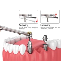 Dental Universal Implant Prosthetic Kit Torque Ratchet Wrench Screw Drivers Remover Dentistry Implant Tools