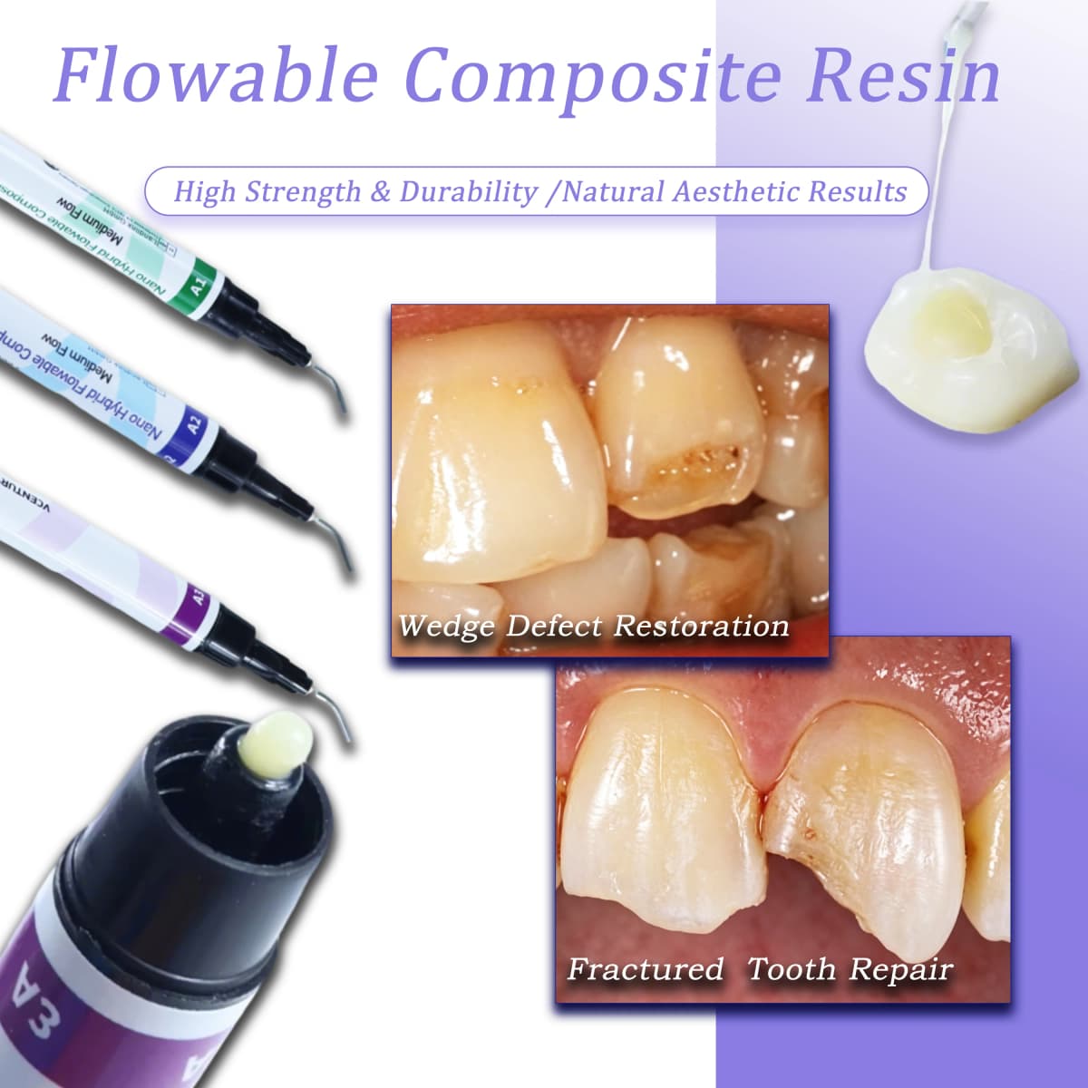 Dental Light-Curable Flowable Composite Resin A1-A3.5 with Etch Gel & Bond Primer for Oral Filling Restoration
