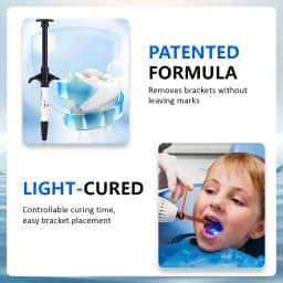 Dental Braces Glue Adhesivos Orthodontic Universal Light-Cure For Bracket Tube Crystal DecorationTeeth Glue Braces Kit With Glue