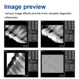 JUMTOP Digital X-ray Dental Sensor Radiography Intraoral Imaging System Fast Transmission Small/Big Size