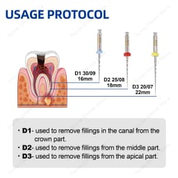 Glin Dental Super D Retreatment Files For Root Canal Treatment Endodontic Files Rotary Files D1-D3 Dentistry Instrument