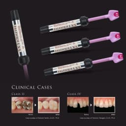 Tokuyama Palfique LX5 Dental Restorative Resin Light Cure Composite Material 3.8g/pcs for Dental Use