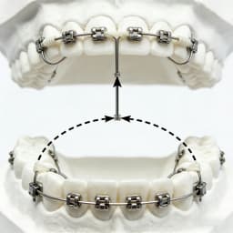10 packs Dental Orthodontic Super Elastic NiTi Arch Wire Rectangular Natural Form For Dental Orthodontic Treatment