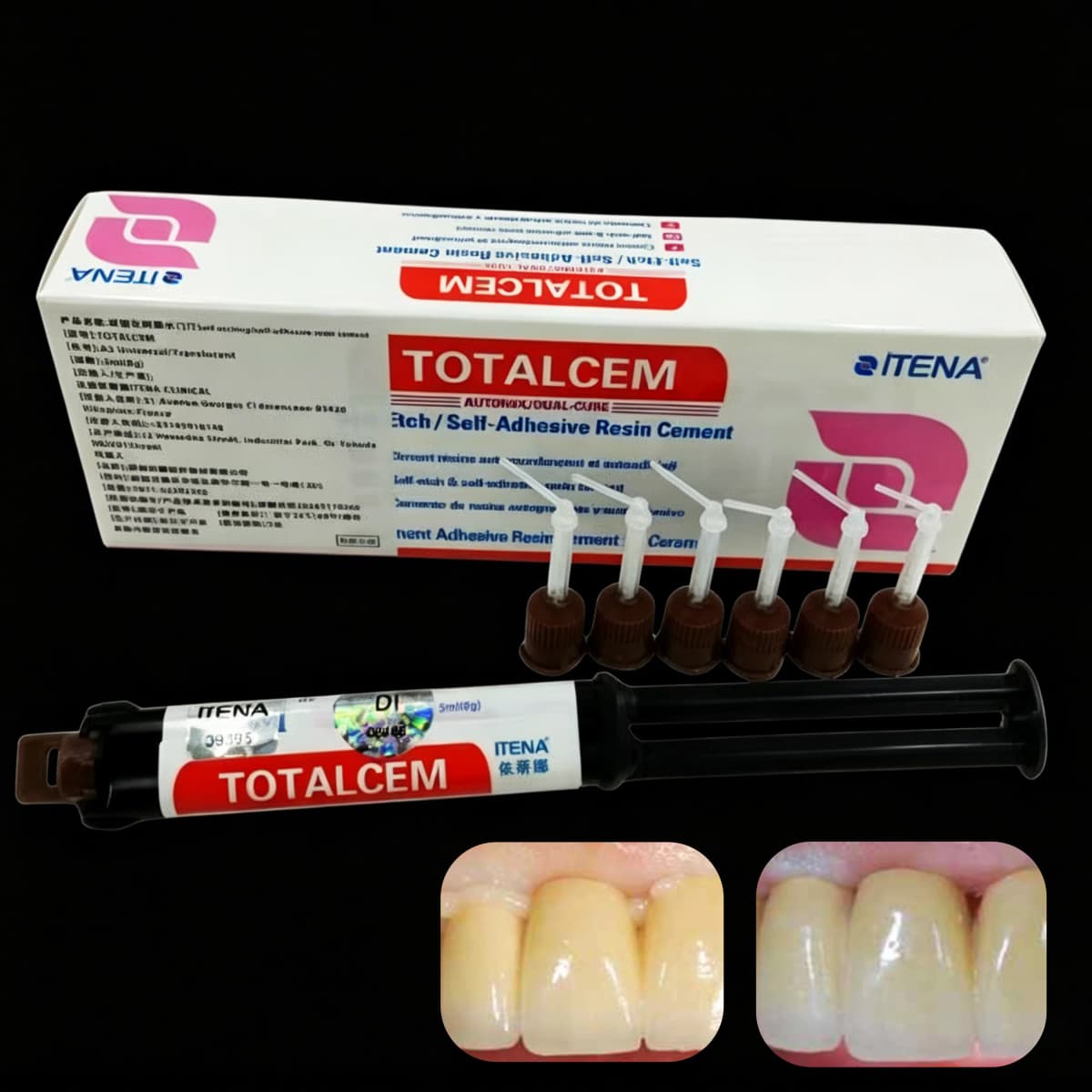 ITENA TOTALCEM Self-Adhesive Dual Cure Resin Cement 8g - Permanent Bonding for Dental Crown, Veneer & Inlay