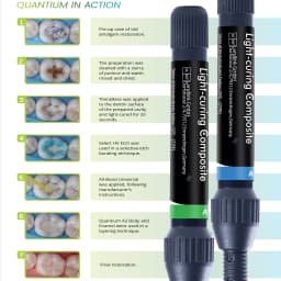 Dental Light-Curing Dental Composite Resin Kit with Etch Gel & Bonding Agent for Cavity Filling Restoration A1/A2/A3