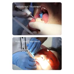 Dental Ultrasonic Piezo Scaler with Detachable Handpiece 5*Tips Automatic frequency fit EMS Cavitron Woodpeck