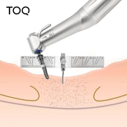 Dental Implant Locating Guide Surgical Planting Positioning Locator Angle Ruler Guage Autoclavable