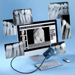 JUMTOP Dental Digital Sensor X Ray RVG Sensor with APS CMOS Tech High-Definition Image System