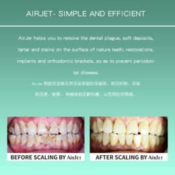 Dental Air Prophy Jet Airjet 1/1S Air Polisher Sandblaster Teeth Polishing Handpiece Hygiene Prophy Jet Machine