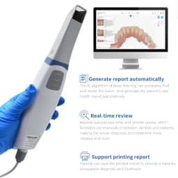 Dental Intraoral 3D Scanner Runyes V3 3.0 Pro, CMD CAD Orthodontic Restoration