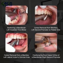 DEASIN Dental Inner&External Channel 1:4.2 Increasing Speed Contra Angle Electric Micromotor 45 Degree Fiber Optic Handpiece