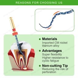 Dental Super Files Blue Rotary File Nickel Titanium Metal Root Canal File Endodontic Equipment 21/25/31mm S1/S2/F1/F2/F3/F4/F5