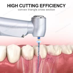 Dental Super Files Blue Rotary File Nickel Titanium Metal Root Canal File Endodontic Equipment 21/25/31mm S1/S2/F1/F2/F3/F4/F5