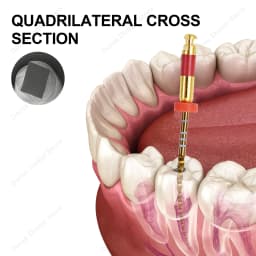 Glin W One Gold Root Canal Files 4 Pcs/Box Heat Activated Flexible Dental Endo Files 21/25mm Niti Rotary Endodontic Files