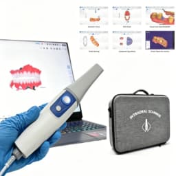 Dental Digital Intraoral Scanner, Al Smart Scanning, Online 3D Viewer