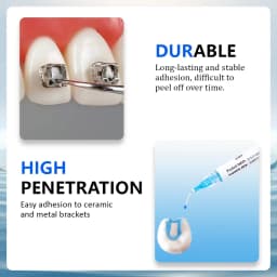 Dental Orthodontic Adhesive Light Cure Braces Glue Kit for Orthodontic Brackets Direct Bonding System Blue Glue