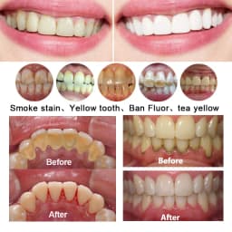 JUMTOP Dental Air Water Polisher Air Powder Spray Sandblaster Oral Hygiene Tooth Cleaning Whitening Polishing Tools