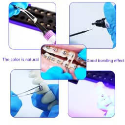Dental Orthodontic Adhesive Light Cure Glue Kit Blue Glue Green Glue Paste Primer Etching Invisible Bonding For Brackets Braces
