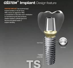 4PCS Osstem TS System Implant Fixture Micro Mini Bone Screw For Professional Orthodontic Surgical Implant Instruments