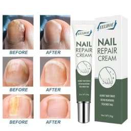 25g Nail Care Cream Anti-fungals Nail Therapy Serum Foot Nail Fungi Removal Gel Anti Infected Paronychia Onychomycosis Product