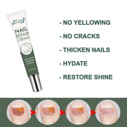 25g Nail Care Cream Anti-fungals Nail Therapy Serum Foot Nail Fungi Removal Gel Anti Infected Paronychia Onychomycosis Product