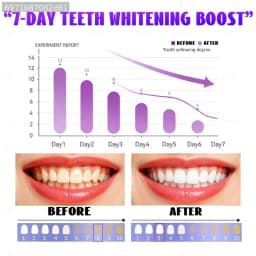 POZOAMIS Purple Orthodontic Toothbrush: Whitens And Brightens Teeth, Breaks Down Stubborn Plaque, Quickly Repairs And Cleans, Removes Black Teeth And Cavities, Freshens Breath, And Is An Oral Care Tool.