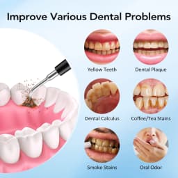 Electric Dental Scaler with Teeth Brush Head Calculus Tartar Remover Vibration Teeth Plaque Cleaner Oral Care Improve Odor