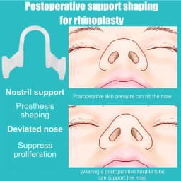 5/10/20Pcs Nose Clip Anti Snoring Soft Nasal Dilator Stop Snore Device for Aid Easy Breathe Improve Sleeping Quality Rhinitis