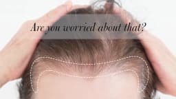 Sevich 5 Colors Concealer Hair Powder Waterproof Black Hairline Shadow Powder Edge Control Hair Concealer Hairline Powder 12g