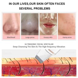 Ultrasonic Skin Scrubber Vibration Face Spatula Blackhead Remover Shovel Clean Cavitation Peeling Facial Lifting Skin Care Tools