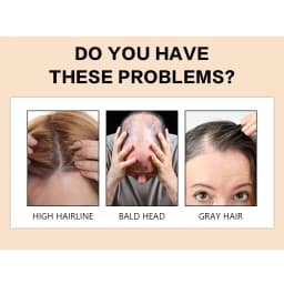 GOIPLE Professional Hair Building Fibers Powder Waterproof Long Lasting Unisex Natural Thickening Hair Anti-loss Fiber Products