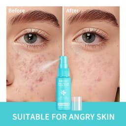 Hypochlorous Acid Spray Toner for Face Helps Reduce Redness Breakouts Soothing pH Balancing Toner Skincare