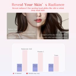 MAXGROOM Ultrasonic Skin Scrubber Peeling Blackhead Remover Deep Face Cleaning Ultrasonic Ion Acne Pore Cleaner Facial Shovel
