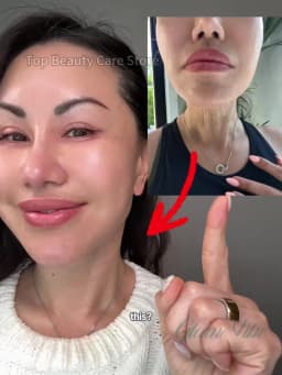 Refined skin, NO of Wrinkles and Fine lines