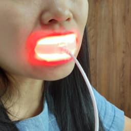 4 In1 USB Rechargeable Oral and Dental Care Red Light Whitening Teeth Bleach Clean Home Travel