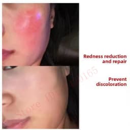 GHK-Cu Blue Copper Peptide 80000U Freeze-Dried Powder Essence Remove Wrinkles And Fine Lines Elasticity Rejuvenating Combination