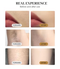 Portable 808 3wave Diode Permanent Hair Remove Fast Depilation Painfree Follicle Penetration Skin Rejuvenation Device