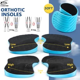 【Xxin】Men Women X Leg Correction Insoles Orthopedic Shoe Pads O Leg Insole Flat Arch Shoe Inserts Size35-46