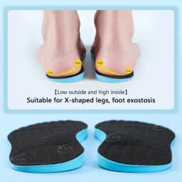 【Xxin】Men Women X Leg Correction Insoles Orthopedic Shoe Pads O Leg Insole Flat Arch Shoe Inserts Size35-46