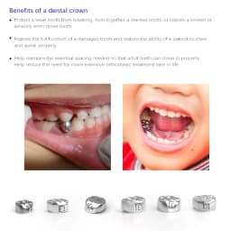 JUMTOP Dental Kid Crowns Primary Molar Temporary Crowns Dentist Tools Orthodontic Materials