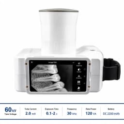 Portable Handheld Dental X-Ray Machine with Touch Screen Built in Display Digital Sensor 60KV High Frequency Wireless Intraoral