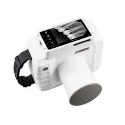 Portable Handheld Dental X-Ray Machine with Touch Screen Built in Display Digital Sensor 60KV High Frequency Wireless Intraoral