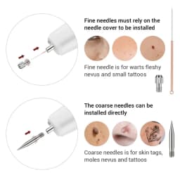 Skin Tag Remover Electric Laser Plasma Pen Black Dot Papilloma Wart Remover Dark Spot Mole Warts Eliminator Lcd Plasma Pen