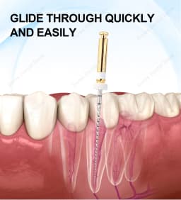 Glin Dental Glide Path Files Endodontics Files Glider 21/25mm Endo Rotary Files Dental Materials Dentistry