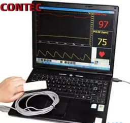 CONTEC Digital PC-Based Pulse Oximeter SPO2 Oxygen Monitor with PC Software And USB CMS-P for Medical Health Monitoring